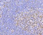 ILF3 Antibody in Immunohistochemistry (Paraffin) (IHC (P))