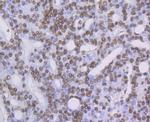 ILF3 Antibody in Immunohistochemistry (Paraffin) (IHC (P))