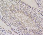 BAP31 Antibody in Immunohistochemistry (Paraffin) (IHC (P))