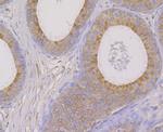 OS9 Antibody in Immunohistochemistry (Paraffin) (IHC (P))