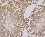 OS9 Antibody in Immunohistochemistry (Paraffin) (IHC (P))