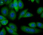 Alcohol Dehydrogenase 1A Antibody in Immunocytochemistry (ICC/IF)