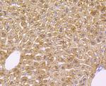 Alcohol Dehydrogenase 1A Antibody in Immunohistochemistry (Paraffin) (IHC (P))