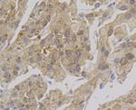 Alcohol Dehydrogenase 1A Antibody in Immunohistochemistry (Paraffin) (IHC (P))