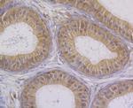 STUB1 Antibody in Immunohistochemistry (Paraffin) (IHC (P))