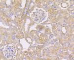 STUB1 Antibody in Immunohistochemistry (Paraffin) (IHC (P))