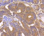 STUB1 Antibody in Immunohistochemistry (Paraffin) (IHC (P))