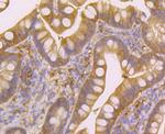 Nudel Antibody in Immunohistochemistry (Paraffin) (IHC (P))