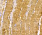 TPM1 Antibody in Immunohistochemistry (Paraffin) (IHC (P))