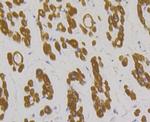 TPM1 Antibody in Immunohistochemistry (Paraffin) (IHC (P))