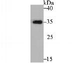 TPM1 Antibody in Western Blot (WB)