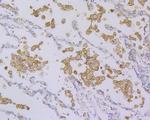 TYROBP Antibody in Immunohistochemistry (Paraffin) (IHC (P))