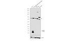 TYROBP Antibody in Western Blot (WB)