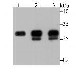 Carbonic Anhydrase I Antibody in Western Blot (WB)