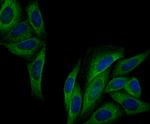 IQGAP1 Antibody in Immunocytochemistry (ICC/IF)