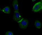 IQGAP1 Antibody in Immunocytochemistry (ICC/IF)