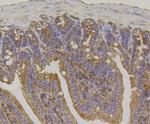 IQGAP1 Antibody in Immunohistochemistry (Paraffin) (IHC (P))