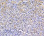 IQGAP1 Antibody in Immunohistochemistry (Paraffin) (IHC (P))