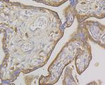 IQGAP1 Antibody in Immunohistochemistry (Paraffin) (IHC (P))