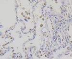 IQGAP1 Antibody in Immunohistochemistry (Paraffin) (IHC (P))