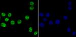 Bub3 Antibody in Immunocytochemistry (ICC/IF)