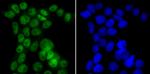 CAF1 p150 Antibody in Immunocytochemistry (ICC/IF)