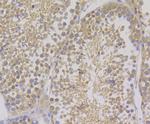 COMT Antibody in Immunohistochemistry (Paraffin) (IHC (P))