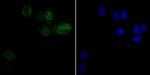 UNC84B Antibody in Immunocytochemistry (ICC/IF)