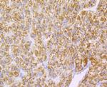 Monoamine Oxidase B Antibody in Immunohistochemistry (Paraffin) (IHC (P))