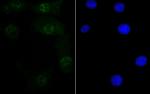 RXRA Antibody in Immunocytochemistry (ICC/IF)