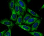 SNX1 Antibody in Immunocytochemistry (ICC/IF)