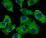 SNX1 Antibody in Immunocytochemistry (ICC/IF)