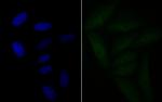 BRD2 Antibody in Immunocytochemistry (ICC/IF)