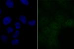 BRD2 Antibody in Immunocytochemistry (ICC/IF)