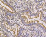 NDUFS4 Antibody in Immunohistochemistry (Paraffin) (IHC (P))