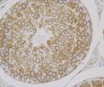 KARS Antibody in Immunohistochemistry (Paraffin) (IHC (P))