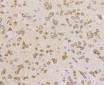 KARS Antibody in Immunohistochemistry (Paraffin) (IHC (P))