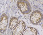 KARS Antibody in Immunohistochemistry (Paraffin) (IHC (P))