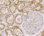 FIS1 Antibody in Immunohistochemistry (Paraffin) (IHC (P))