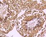 XPO5 Antibody in Immunohistochemistry (Paraffin) (IHC (P))