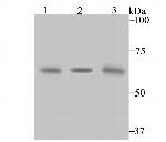 CBS Antibody in Western Blot (WB)