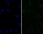 BAF57 Antibody in Immunocytochemistry (ICC/IF)