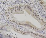 BAF57 Antibody in Immunohistochemistry (Paraffin) (IHC (P))