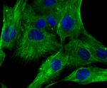 LUM Antibody in Immunocytochemistry (ICC/IF)