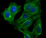 LUM Antibody in Immunocytochemistry (ICC/IF)