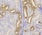 LUM Antibody in Immunohistochemistry (Paraffin) (IHC (P))