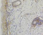 LUM Antibody in Immunohistochemistry (Paraffin) (IHC (P))