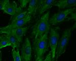 FBXO32 Antibody in Immunocytochemistry (ICC/IF)