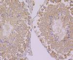 PEN2 Antibody in Immunohistochemistry (Paraffin) (IHC (P))