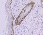 DDB2 Antibody in Immunohistochemistry (Paraffin) (IHC (P))